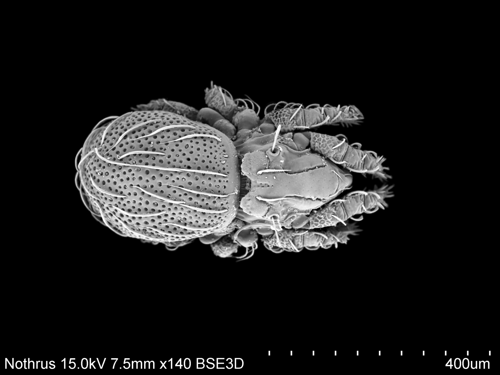 Ácaro en microscopía electrónica